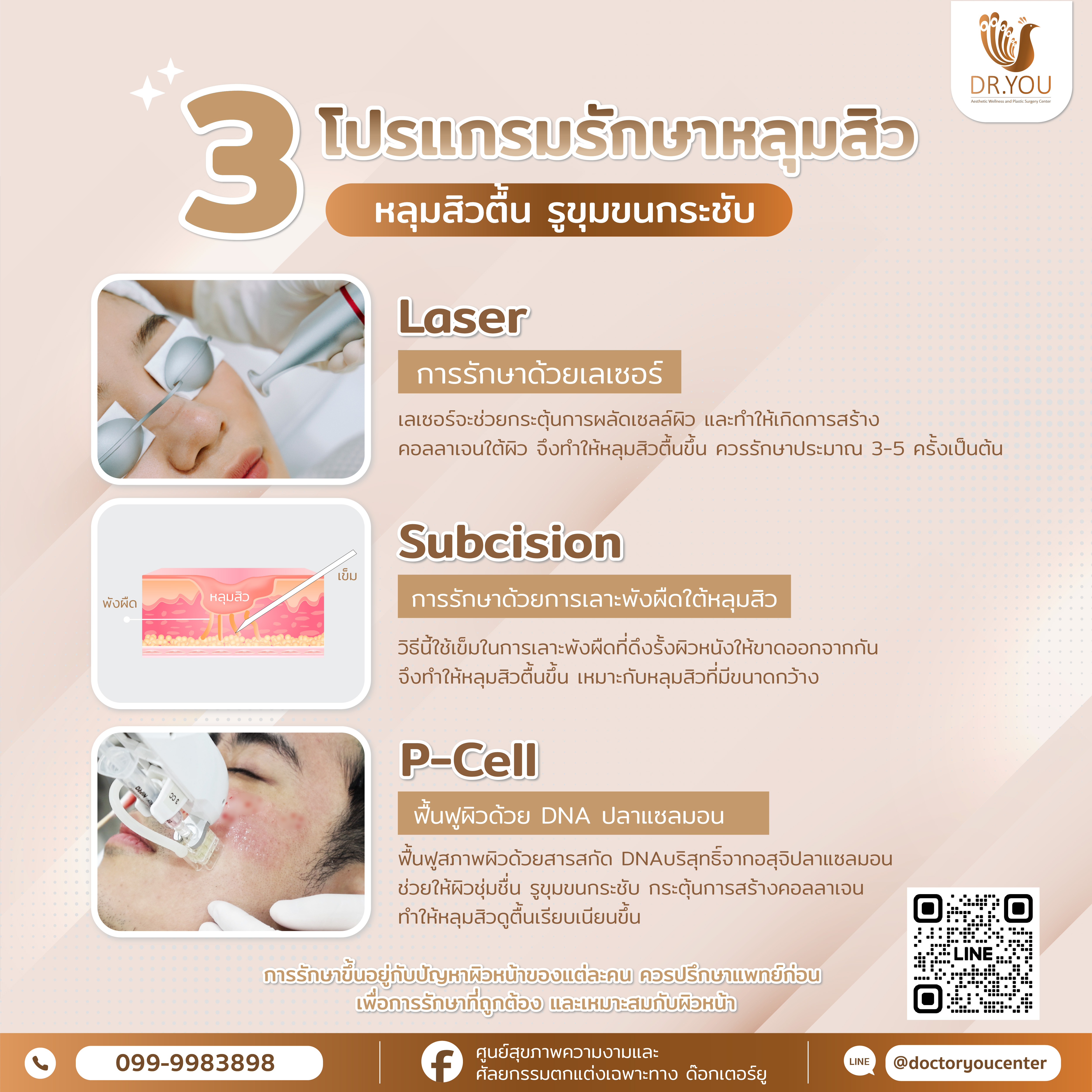 3 โปรแกรมรักษาหลุมสิว หลุมสิวตื้น รูขุมขนกระชับ