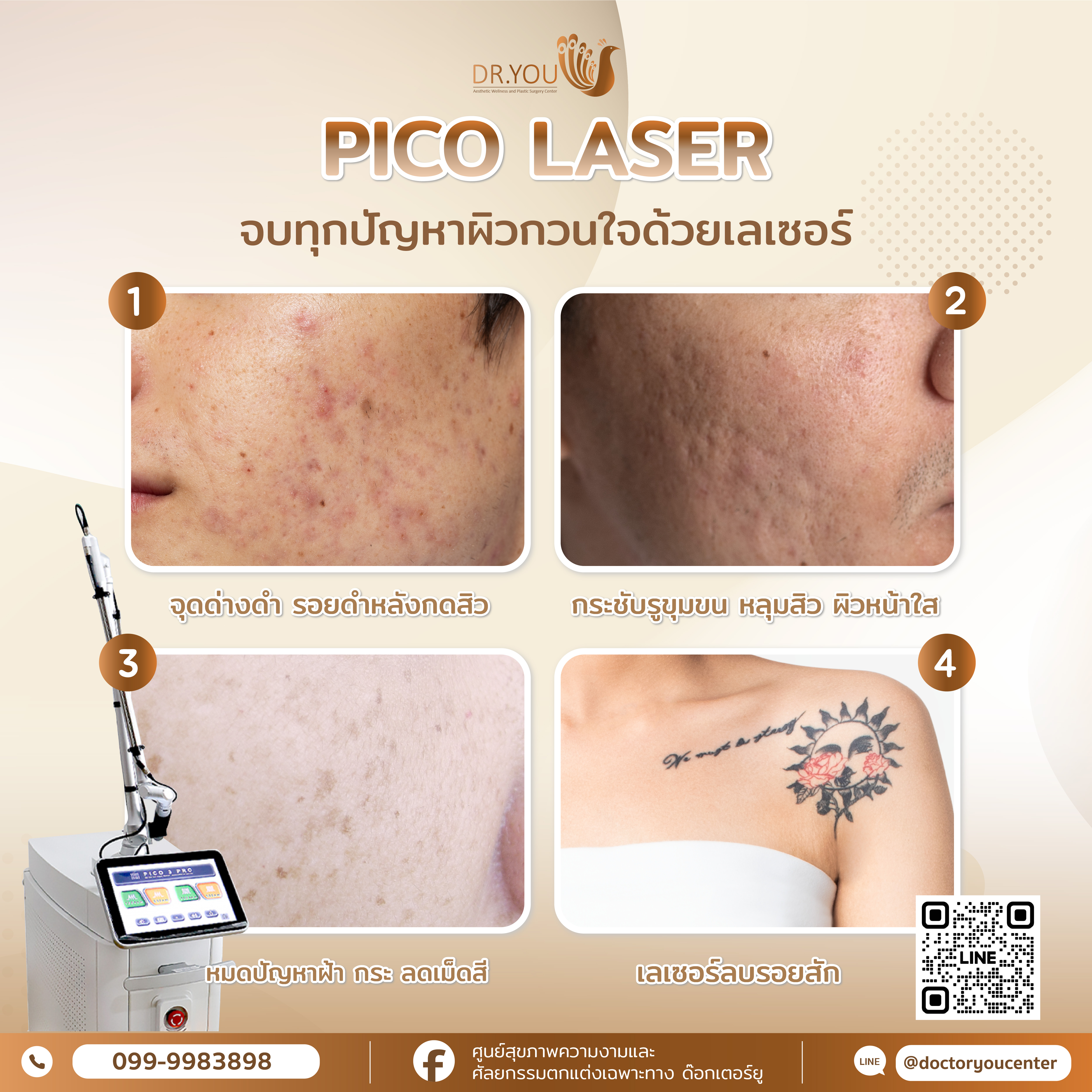 Pico Laser จบปัญหาผิวกวนใจด้วยเลเซอร์