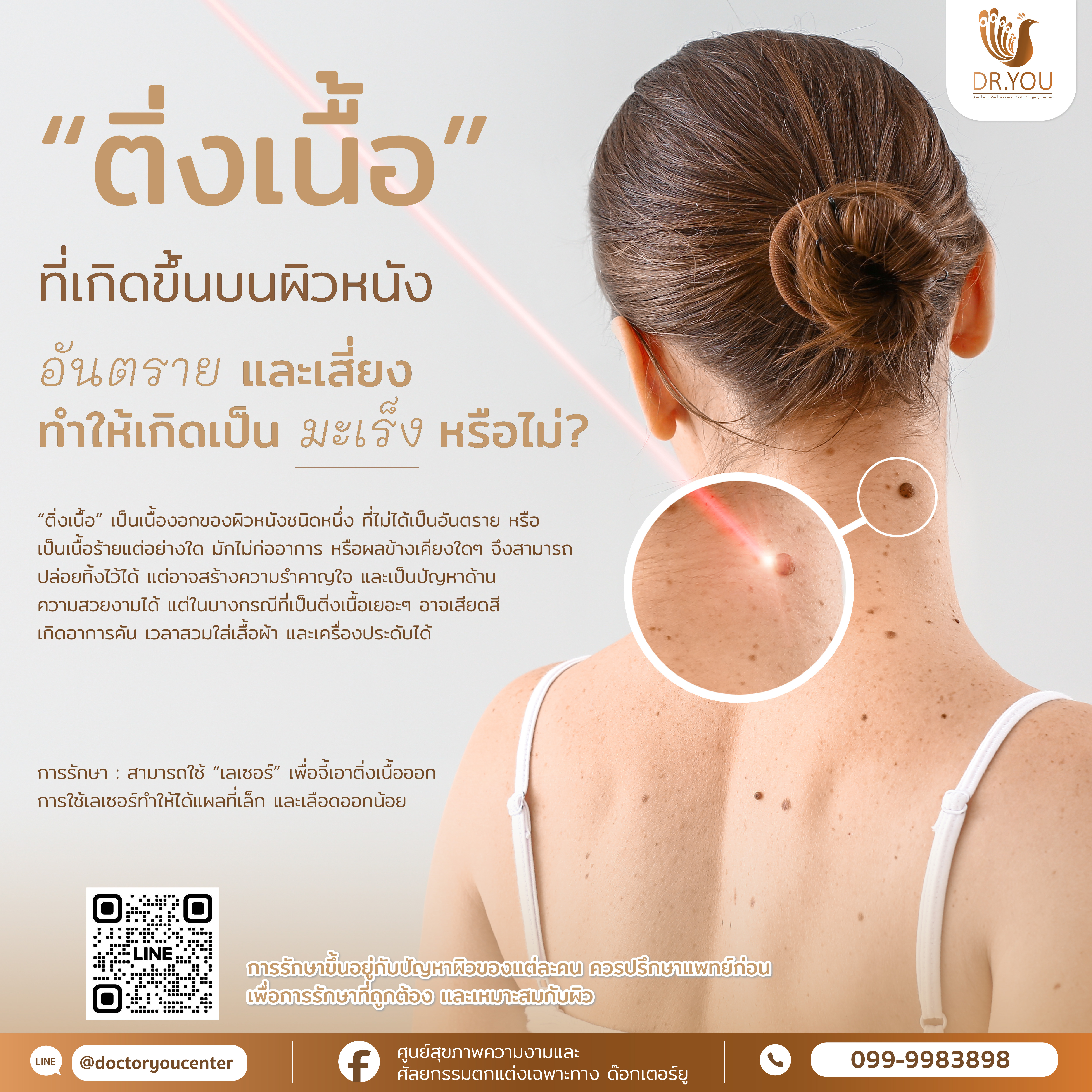 ติ่งเนื้อบนผิวหนังอันตรายหรือไม่ เสียงเกิดเป็นมะเร็งไหม?